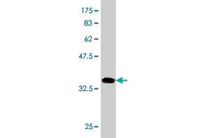 Western Blot detection against Immunogen (36. (TRAPPC10 抗体  (AA 1162-1257))