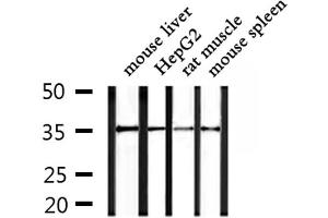 Western blot analysis of extracts from mouse liver and HepG2 and rat muscle and mouse spleen, using OR4F15 Antibody. (OR4F15 抗体)