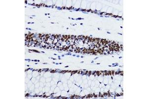 Immunohistochemistry of paraffin-embedded human colon using Acetyl-Histone H2B-K12 antibody (ABIN7267731) at dilution of 1:200 (40x lens). (Histone H2B 抗体  (acLys12))