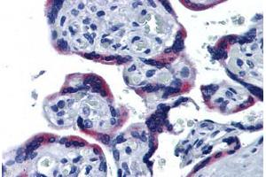 Human Placenta: Formalin-Fixed, Paraffin-Embedded (FFPE) (ERP44 抗体  (AA 30-407))