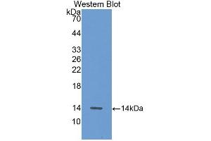 Western blot analysis of the recombinant protein. (ALT 抗体  (AA 147-263))
