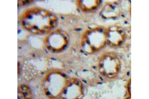 Used in DAB staining on fromalin fixed paraffin-embedded Kidney tissue (EGF 抗体  (AA 977-1029))