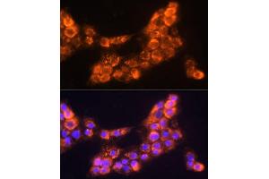Immunofluorescence analysis of  cells using L Polyclonal Antibody (ABIN6128174, ABIN6143076, ABIN6143077 and ABIN6219002) at dilution of 1:100 (40x lens). (LAMC2 抗体  (AA 862-1111))