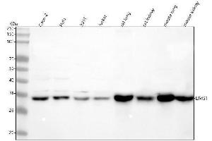 Western blot analysis of LIMS1 using anti-LIMS1 antibody (ABIN7599708).