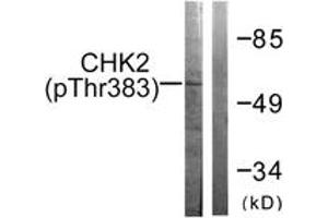 Western blot analysis of extracts from COS7 cells treated with UV 30', using Chk2 (Phospho-Thr383) Antibody. (CHEK2 抗体  (pThr383))