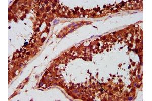 Immunohistochemistry (IHC) image for anti-TBC1 (Tre-2/USP6, BUB2, Cdc16) Domain Family, Member 1 (TBC1D1) (AA 566-718) antibody (ABIN7171594)