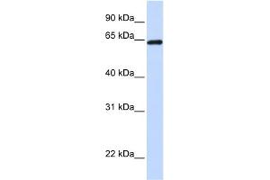 WB Suggested Anti-LCP1 Antibody Titration: 0. (LCP1 抗体  (C-Term))