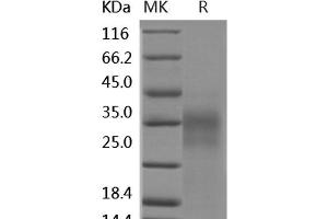 Western Blotting (WB) image for Tumor Necrosis Factor (Ligand) Superfamily, Member 8 (TNFSF8) protein (ABIN7198395) (TNFSF8 蛋白)
