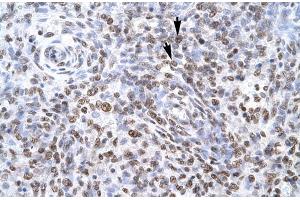 Human Spleen; ZNF500 antibody - middle region in Human Spleen cells using Immunohistochemistry (ZNF500 抗体  (Middle Region))