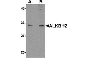 Western blot analysis of ALKBH2 in human kidney tissue lysate with ALKBH2 antibody at (A) 1 and (B) 2 μg/ml. (ALKBH2 抗体  (C-Term))