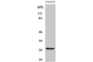 Western Blotting (WB) image for anti-Tumor Protein P53 Inducible Nuclear Protein 1 (TP53INP1) (C-Term) antibody (ABIN3187308) (TP53INP1 抗体  (C-Term))