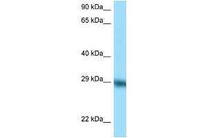 WB Suggested Anti-TFPI Antibody Titration: 1. (TFPI 抗体  (C-Term))