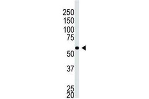 Western blot testing of BACE2C antibody and A549 cell lysate (BACE2C 抗体  (AA 310-339))