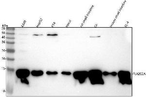 Western blot analysis of PLA2G2A using anti-PLA2G2A antibody (ABIN7605976).