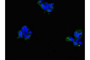 Immunofluorescent analysis of 293 cells using ABIN7169906 at dilution of 1:100 and Alexa Fluor 488-congugated AffiniPure Goat Anti-Rabbit IgG(H+L) (SLC4A7 抗体  (AA 240-400))