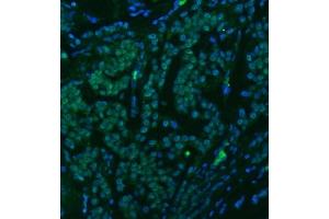 IF analysis of U1-C/SNRPC using anti-U1-C/SNRPC antibody (ABIN7599016).