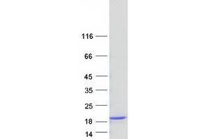 Fatty Acid Binding Protein 9, Testis (FABP9) protein (Myc-DYKDDDDK Tag)