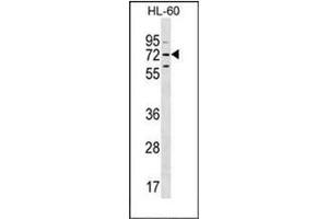 Western blot analysis of MBTD1 Antibody (C-term) in HL-60 cell line lysates (35ug/lane).