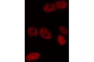 ABIN6275720 staining Hela by IF/ICC. (IKZF2 抗体  (Internal Region))
