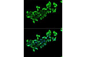Immunofluorescence analysis of U2OS cells using FLOT1 antibody. (Flotillin 1 抗体  (AA 128-427))