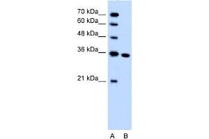 WB Suggested Anti-SLC25A29 Antibody Titration:  1. (SLC25A29 抗体  (C-Term))
