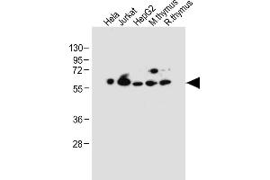 All lanes : Anti-PDCD4 Antibody (Center) at 1:2000 dilution Lane 1: Hela whole cell lysate Lane 2: Jurkat whole cell lysate Lane 3: HepG2 whole cell lysate Lane 4: Mouse thymus tissue lysate Lane 5: Rat thymus tissue lysate Lysates/proteins at 20 μg per lane. (PDCD4 抗体  (AA 121-149))