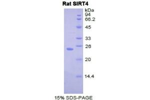 SDS-PAGE analysis of Rat Sirtuin 4 Protein. (SIRT4 蛋白)