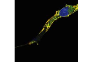 Immunocytochemistry analysis of colocalization of R-Ras2/TC21 signal (red) and GFP signal (green) in COS cells transfected with R-Ras2/TC21-GFP construct, after fixation and permeabilization. (RRAS2 抗体)