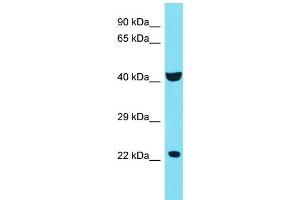 Host: Rabbit Target Name: C4orf51 Sample Type: 721_B Whole Cell lysates Antibody Dilution: 1. (C4ORF51 抗体  (C-Term))