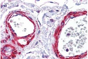 Human Vessels: Formalin-Fixed, Paraffin-Embedded (FFPE) (SIRT5 抗体  (AA 179-228))