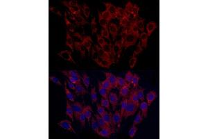 Immunofluorescence analysis of C6 cells using SURF4 Rabbit pAb (ABIN7270650) at dilution of 1:100 (40x lens). (Surfeit 4 抗体  (AA 50-150))
