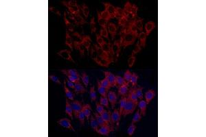Immunofluorescence analysis of C6 cells using SURF4 Rabbit pAb (ABIN7270650) at dilution of 1:100 (40x lens). (Surfeit 4 抗体  (AA 50-150))