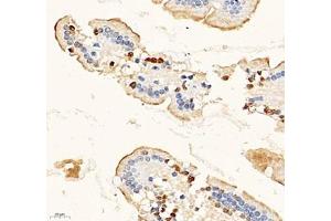 Immunohistochemistry of paraffin embedded mouse duodenum using MAL2 (ABIN7074549) at dilution of 1: 700 (400x lens) (MAL2 抗体)