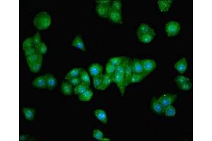 Immunofluorescent analysis of PC-3 cells using ABIN7176445 at dilution of 1:100 and Alexa Fluor 488-congugated AffiniPure Goat Anti-Rabbit IgG(H+L) (ZNF624 抗体  (AA 127-327))