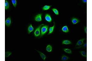 Immunofluorescence staining of A549 cells with ABIN7160437 at 1:133, counter-stained with DAPI. (Chromosome 11open Reading Frame 9 (C11orf9) (AA 843-1004) 抗体)