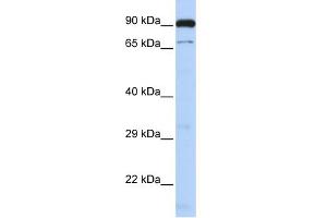 WB Suggested Anti-CTCFL Antibody Titration:  0. (CTCFL 抗体  (N-Term))