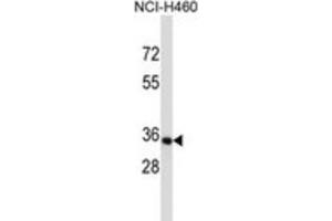 Western Blotting (WB) image for anti-Olfactory Receptor, Family 14, Subfamily C, Member 36 (OR14C36) antibody (ABIN5017126) (OR14C36 抗体)