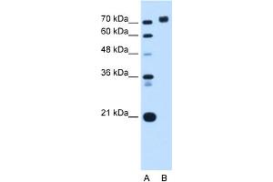 Western Blotting (WB) image for anti-Protein Tyrosine Phosphatase, Receptor Type, N (PTPRN) (Middle Region) antibody (ABIN2782197)