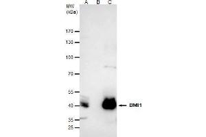 IP Image Bmi1 antibody immunoprecipitates Bmi1 protein in IP experiments. (BMI1 抗体  (Center))