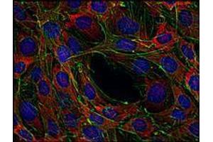 Immunofluorescence (IF) image for anti-Son of Sevenless Homolog 1 (SOS1) antibody (ABIN238504) (SOS1 抗体)