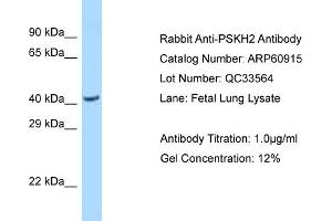 Western Blotting (WB) image for anti-Protein Serine Kinase H2 (PSKH2) (N-Term) antibody (ABIN2788622) (PSKH2 抗体  (N-Term))