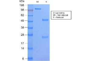 SDS-PAGE Analysis Purified HLA-DP Rabbit Recombinant Monoclonal Ab (HLA-DPB1/2862R).