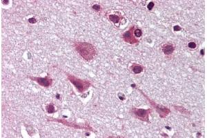 Human Brain, Cortex (formalin-fixed, paraffin-embedded) stained with MAPK9 antibody ABIN293094 at 20 ug/ml followed by biotinylated goat anti-rabbit IgG secondary antibody ABIN481713, alkaline phosphatase-streptavidin and chromogen.