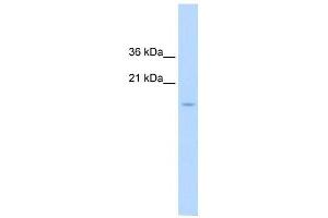 CENPA antibody used at 1. (CENPA 抗体  (N-Term))