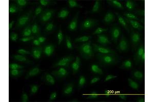 Immunofluorescence of monoclonal antibody to PSCD3 on HeLa cell. (Cytohesin 3 抗体  (AA 1-180))