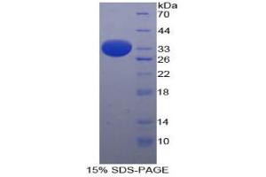 SDS-PAGE analysis of Human ARRB1 Protein. (beta Arrestin 1 蛋白)