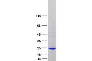 Western Blotting (WB) image for RAB, Member RAS Oncogene Family-Like 5 (RABL5) (Transcript Variant 1) protein (Myc-DYKDDDDK Tag) (ABIN2730389)