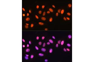 Immunofluorescence analysis of U-2 OS cells using Ku70 Rabbit mAb (ABIN7271407) at dilution of 1:100 (40x lens). (XRCC6 抗体)