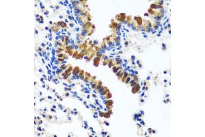 Immunohistochemistry of paraffin-embedded mouse lung using CAMLG antibody (ABIN6129359, ABIN6137896, ABIN6137897 and ABIN6217819) at dilution of 1:100 (40x lens). (CAMLG 抗体  (AA 1-190))