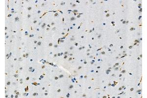 ABIN6265191 and ABIN6273164 at 1/100 staining Rat brain tissue by IHC-P. (SMOX 抗体  (Internal Region))